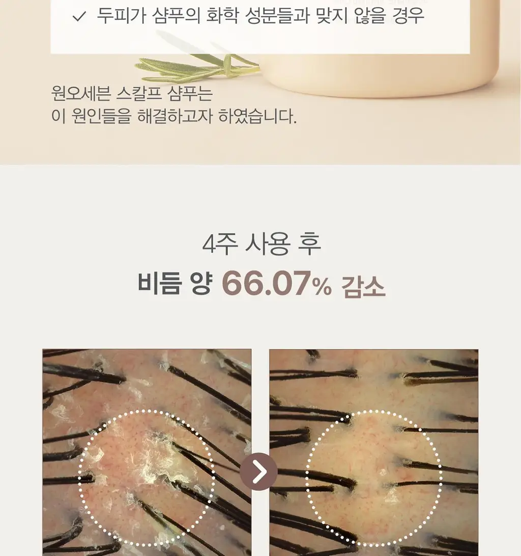 [탈모증상완화/식초샴푸] 원오세븐 스칼프 퓨리파잉 마이크로바이옴 샴푸 380ml 상세페이지 5